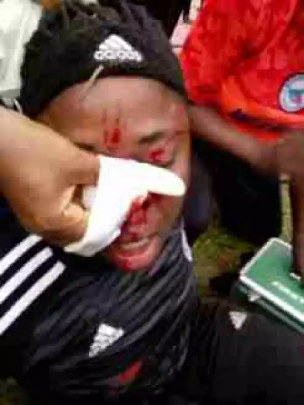 Fans Of Bayelsa Queens Attack Sunshine Queens FC Players After Match (Photos)